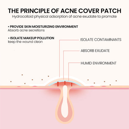 Fade Blemishes Pimple Acne Patch